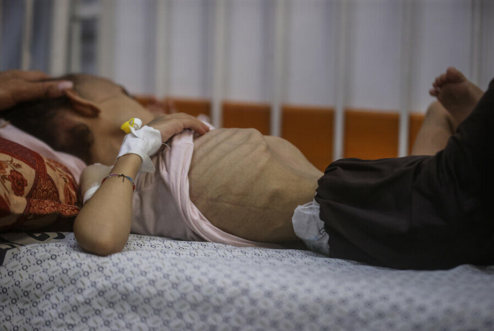 GAZA: Helsearbeidere og skolebarn er drept, og FN har erklært hungersnød. Bildet viser et barn som får behandling for alvorlig underernæring.